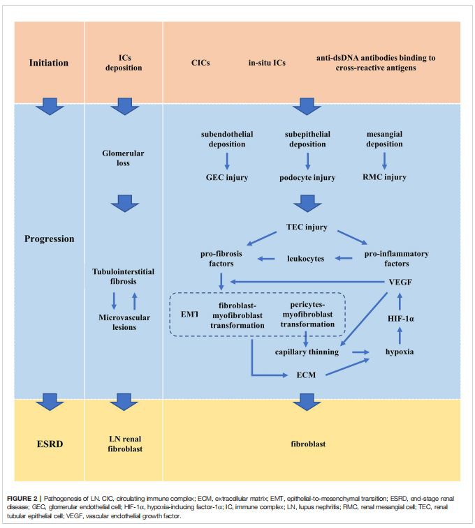 FIGURE 2 | Pathogenesis of LN. CIC, circulating immune complex; ECM, extracellular matrix; EMT, epithelial-to-mesenchymal transition; ESRD, end-stage renal disease; GEC, glomerular endothelial cell; HIF-1a, hypoxia-inducing factor-1a; IC, immune complex; LN, lupus nephritis; RMC, renal mesangial cell; TEC, renal tubular epithelial cell; VEGF, vascular endothelial growth factor. FIGURE 2 | Pathogenesis of LN. CIC, circulating immune complex; ECM, extracellular matrix; EMT, epithelial-to-mesenchymal transition; ESRD, end-stage renal disease; GEC, glomerular endothelial cell; HIF-1a, hypoxia-inducing factor-1a; IC, immune complex; LN, lupus nephritis; RMC, renal mesangial cell; TEC, renal tubular epithelial cell; VEGF, vascular endothelial growth factor.